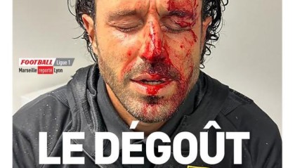 乐鱼体育-王勤伯：格罗索遇袭让巴黎奥运安保蒙上更多阴影